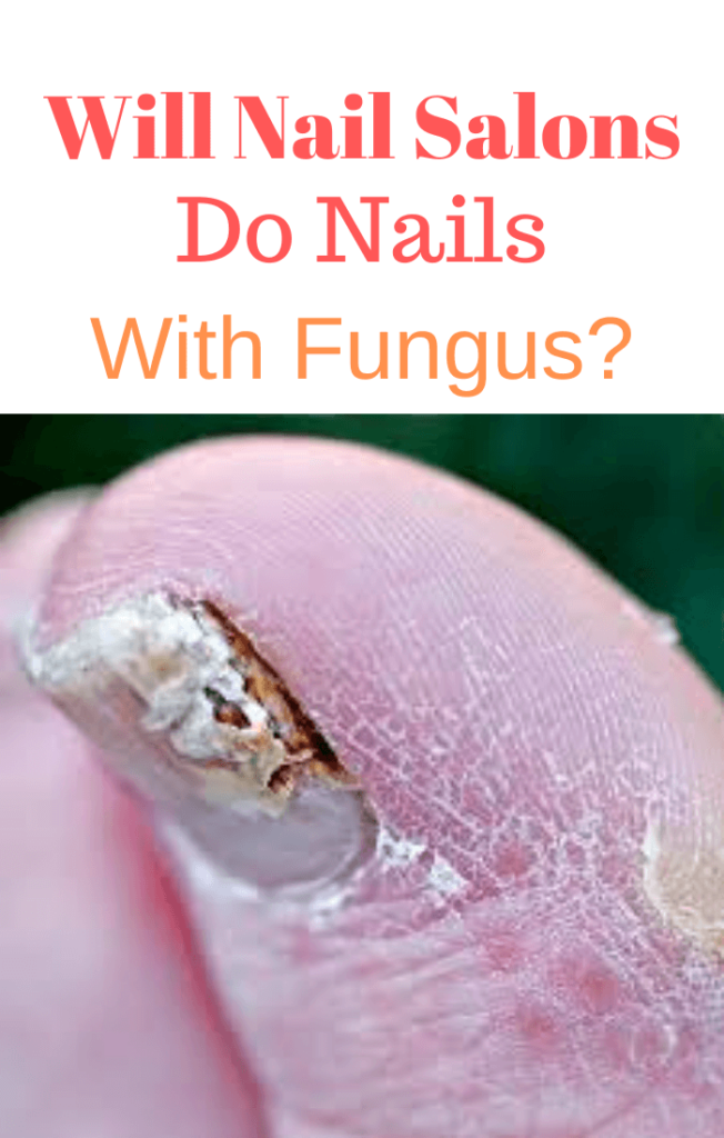 will-nail-salons-do-nails-with-fungus.