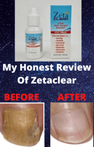 review of zetaclear