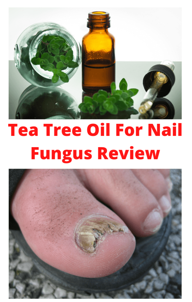 Tea-Tree-Oil-For-Nail-Fungus-Review