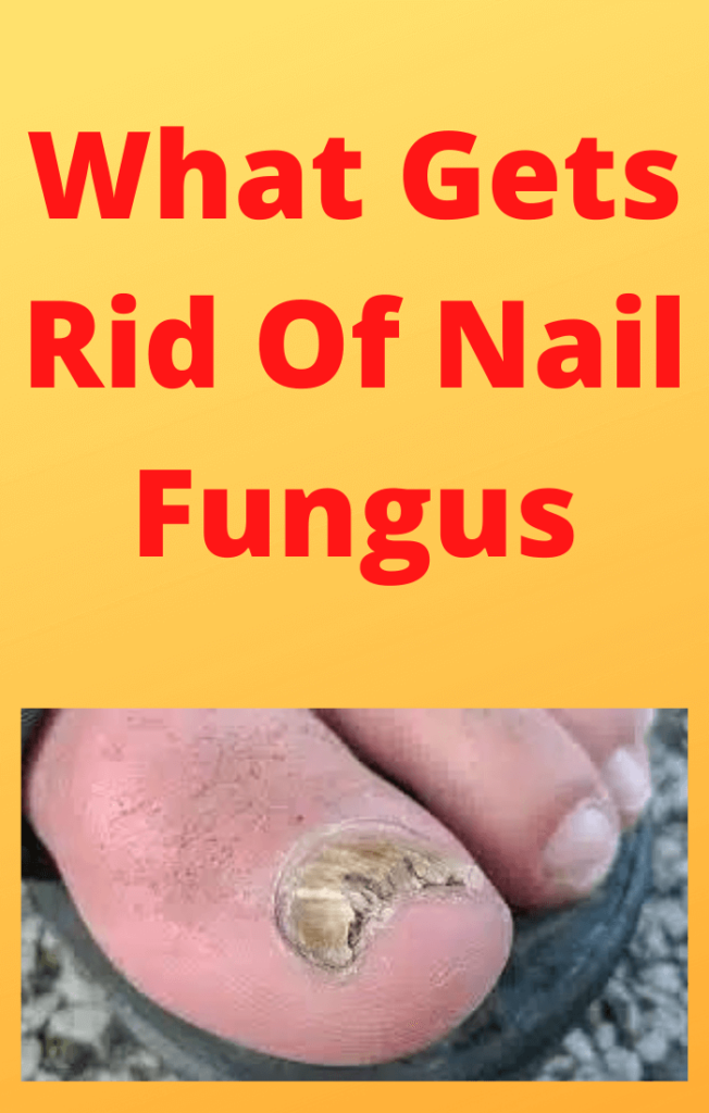 What-Gets-Rid-Of-Nail-Fungus