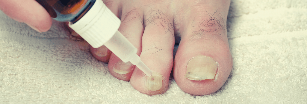 What Essential Oil Is Good For Nail Fungus